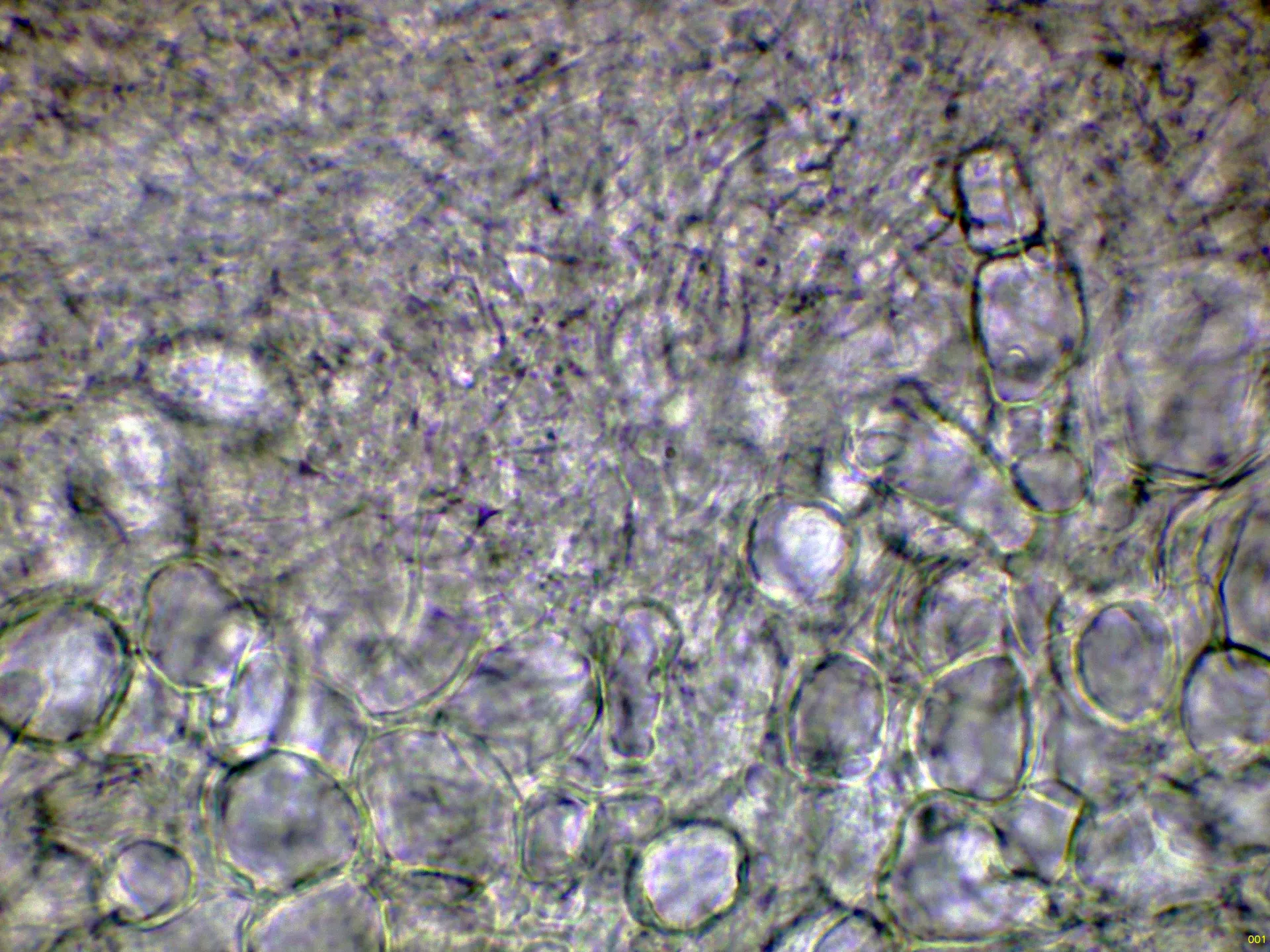 Microscopía de Russula faginea - 10 - Subpellis agua-001